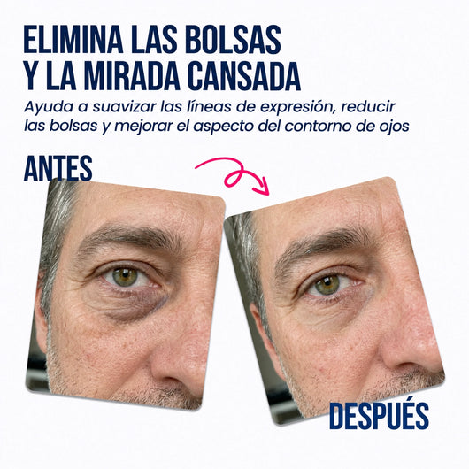 Parches reparadores para el contorno de ojos